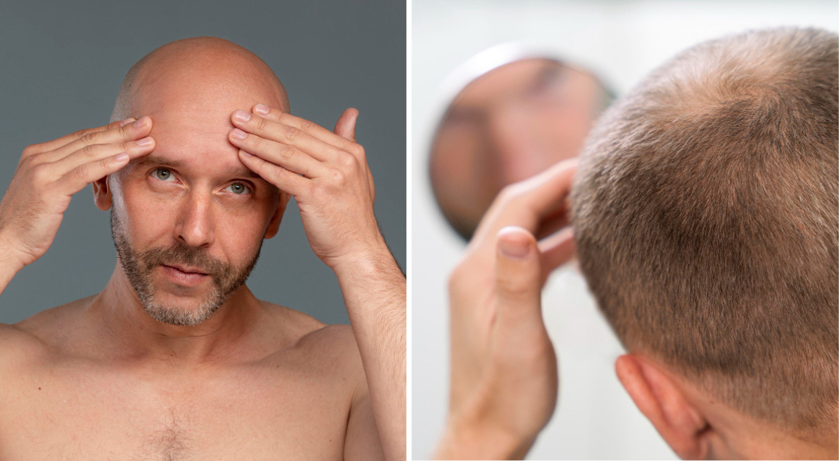 beste mittel gegen haarausfall bei frauen