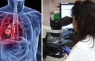 Lotta al tumore ai polmoni: testato con successo un nuovo farmaco più potente della chemioterapia