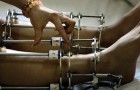 Farsi operare per essere più alti: in India spopola tra i giovani l'assurdo intervento chirurgico