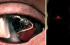 Eyeborg: quest'uomo si è fatto impiantare una protesi-telecamera nell'occhio destro