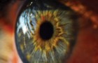 Die erste organische Linse ist aus Italien und wird Millionen von Menschen das Augenlicht wiedergeben