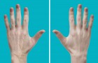 Keep your hands looking younger longer! Here's how!