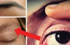 What causes the uncontrollable twitching of an eyelid? Here are some explanations ...