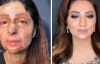 La transformation de ces femmes grâce au maquillage est à la fois belle et bouleversante.