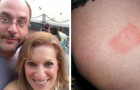 A man dies from a tick bite and his wife tells the tragic experience to inform as many people as possible