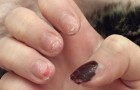 Soins des ongles : Les photos de cette jeune fille nous mettent en garde contre les risques du nail art