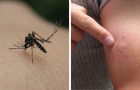 Here's why you're bitten by mosquitoes far more than anyone else!