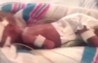 De premature baby van 22 weken wordt door 16 ziekenhuizen 