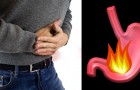 7 foods that might help alleviate Acid reflux without the assistance of medication