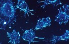 De zelfvernietigingscode van kankercellen ontdekt: het kan ons helpen om ze selectief te elimineren