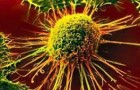 I ricercatori hanno scoperto un killer naturale di cellule tumorali, e adesso stanno cercando di potenziarlo