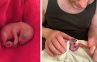 A man finds a baby squirrel abandoned on his bed and decides to raise it