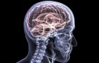 Wetenschappers staan op het punt een behandeling die Alzheimer omkeert nu op mensen te gaan testen