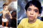 Het verhaal van de kleine David Vetter, het kind dat twaalf jaar in een bubbel leefde