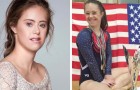 Cette gymnaste championne du monde atteinte de trisomie 21 défie l'idéal de beauté et devient mannequin