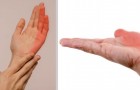 Las 7 causas más frecuentes de entumecimiento a las manos, que no deberían pasar inadvertidas