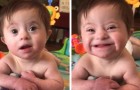De adoptiemoeder van dit meisje met het syndroom van Down heeft haar eerste glimlach vereeuwigd