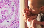 Hören wir auf, Neugeborene zu küssen: Die Wintersaison erhöht das Risiko von Atemwegsinfektionen