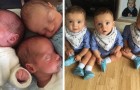 These triplets were born two and a half months early and against all expectations, they survived and are strong and healthy