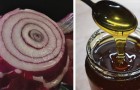 Sirop au miel et à l'oignon : un remède maison efficace contre la toux