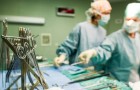 Un uomo ha ricevuto un trapianto di polmoni, fegato e pancreas: è il primo caso in Europa