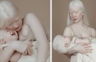 Ces deux sœurs albinos sont nées à 12 ans d'intervalle : leur apparence est unique et fascinante