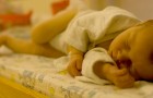 Coronavirus, een baby van 6 weken oud, is het eerste pediatrische slachtoffer van Covid-19 in de Verenigde Staten