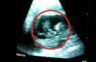Une échographie qui montre la manière dont un enfant s'amuse dans l'utérus