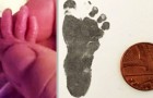 Francesca è nata prematura a 24 settimane: il suo piedino è grande quanto la monetina da 1 centesimo
