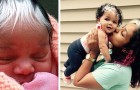 This girl was born with a singular tuft of white hair: a unique and fascinating distinctive trait