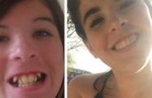 11 foto dimostrano come un bravo dentista può trasformare il volto di una persona