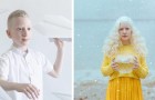 Una fotografa ha immortalato tutta la bellezza poetica delle persone albine in una serie di scatti magici