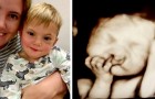 Er is iets mis met de foetus, maar ze weigeren de zwangerschap af te breken: 2 jaar later zijn ze gelukkiger dan ooit