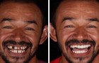 Un dentista brasiliano regala un nuovo sorriso ai meno fortunati: 20 foto mostrano le incredibili trasformazioni