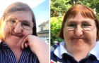 La bullizzavano sul web per la sua disabilità: lei risponde pubblicando selfie per un anno