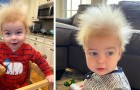 This little boy has uncombable hair syndrome (UHS): 