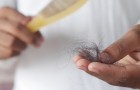 Alopezie: Was ist das, warum tritt sie auf und wie kann man die Krankheit, die Haarausfall verursacht, behandeln?