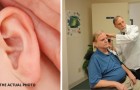 La recherche découvre une thérapie qui peut remédier à la perte d'audition sans implants