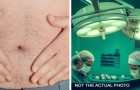 En 33-årig man klagar varje månad på magsmärtor och upptäcker slutligen att han har äggstockar och en livmoder