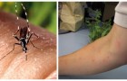 5 modi fai-da-te da provare per evitare le punture di zanzare