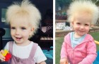 Das kleine Mädchen mit den unbezwingbaren Haaren: Eine extrem seltene Krankheit hat sie zu einem kleinen sozialen Star gemacht