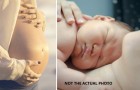 Sie leidet während der Schwangerschaft unter starkem Juckreiz und roten Flecken auf ihrem Bauch: Sie ist allergisch gegen ihr eigenes Kind