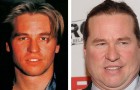 Les photos avant et après de 12 célébrités défigurées par la chirurgie plastique (et pas seulement)