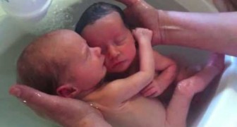 L'infermiera immerge questi gemelli appena nati: il loro legame è un miracolo della vita