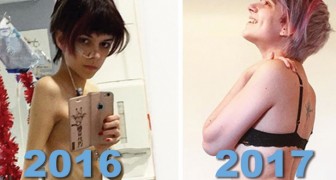Vaincre l'anorexie: les photos de leurs nouvelles vies n'ont pas besoin de mots