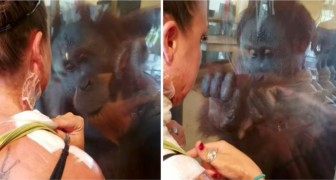 Una scimmia si avvicina ad una donna sfigurata dal fuoco: la sua reazione lascia tutti senza parole