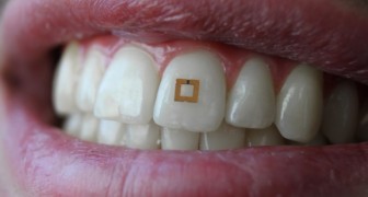 Si attacca ai denti e monitora la tua dieta: ecco il chip che ti dice cosa mangi