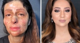 De verandering van deze vrouwen dankzij de make-up is prachtig en tegelijkertijd hartverscheurend