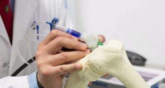 BioPen, le stylo qui imprime des cellules souches en 3D pour régénérer le cartilage et les os