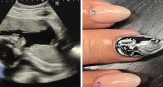 Nails decorated with the ultrasound of your child! Here is a new and bizarre fashion that is sweeping England!